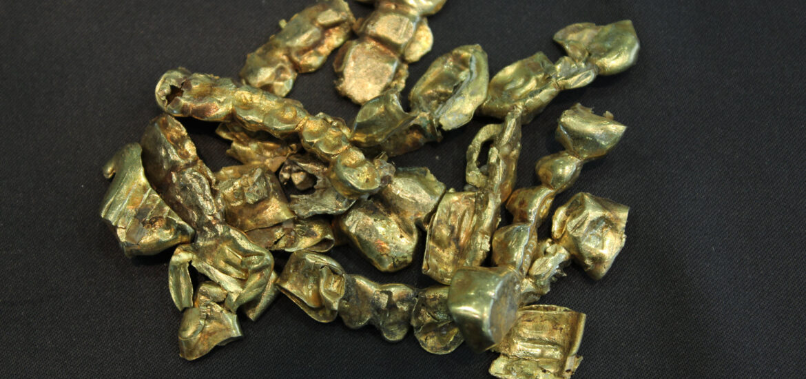 Zahngold, Goldzähne Goldbrücken goldkronen, Gold in den Zähnen