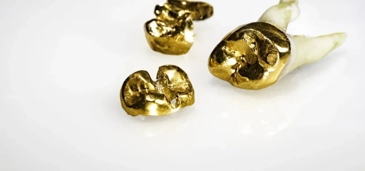Zahngold Zahnkronen mit Goldfüllungen Zahngold Ankauf bei Juwelier Sascha in Wien