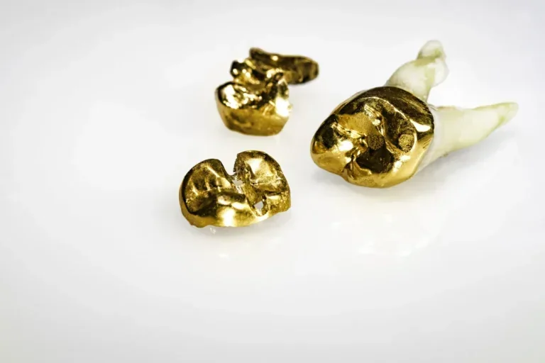 Zahngold Zahnkronen mit Goldfüllungen Zahngold Ankauf bei Juwelier Sascha in Wien